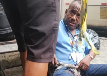 O manuseio de um explosivo caseiro na Ilha do Governador, Rio de Janeiro, feriu oito pessoas, duas em estado grave. A polícia investiga a origem e as circunstâncias da detonação.