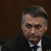 O ex-presidente Jair Bolsonaro deixou a UTI e foi transferido para a unidade semi-intensiva do Hospital DF Star, em Brasília, após apresentar melhora em seu estado de saúde.