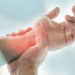 Fibromialgia é doença crônica que causa dores intensas, fadiga e distúrbios do sono. Em casos graves, pacientes podem ter acesso a benefícios do INSS.