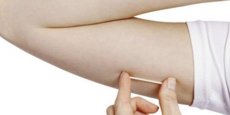 Alerj vota projeto que amplia campanha sobre métodos contraceptivos e inclui implante subdérmico no Estado do Rio.