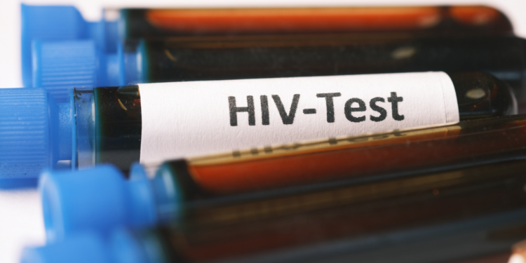 Fiocruz Bahia inicia estudo inovador com PrEP para prevenção do HIV entre jovens de áreas periféricas, envolvendo 1,4 mil participantes e acompanhamento de até 12 meses.