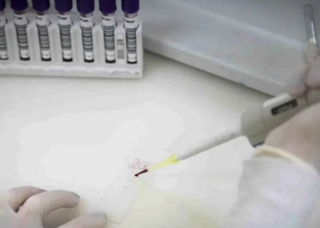 Autoridades de saúde descartam ebola em dois casos suspeitos no Brasil, no Rio de Janeiro e em São Paulo. Pacientes seguem internados e sob investigação por outras doenças.