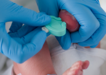 Diagnóstico tardio e demora no acesso ao tratamento ainda desafiam pacientes com AME no Brasil, especialmente nos casos mais graves.