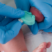 Diagnóstico tardio e demora no acesso ao tratamento ainda desafiam pacientes com AME no Brasil, especialmente nos casos mais graves.