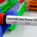 Doença de Creutzfeldt-Jakob não tem cura, mas pesquisas investigam novos tratamentos e métodos para diagnóstico mais preciso.