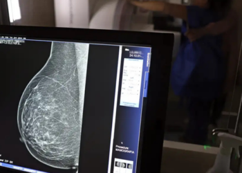 Planos de saúde terão de cobrir mamografia digital sem limite de idade ou gênero a partir de 1º de outubro, desde que haja indicação médica.
