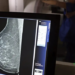 Planos de saúde terão de cobrir mamografia digital sem limite de idade ou gênero a partir de 1º de outubro, desde que haja indicação médica.