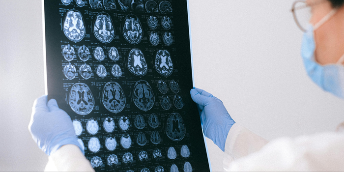 Hospital em Porto Alegre oferece teste sanguíneo para investigar Alzheimer. Exame custa cerca de R$ 3 mil e exige avaliação médica.