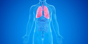 Pesquisa com pacientes do Amazonas identifica alta frequência de mutação no gene EGFR em casos de câncer de pulmão, reforçando a importância de testes moleculares.